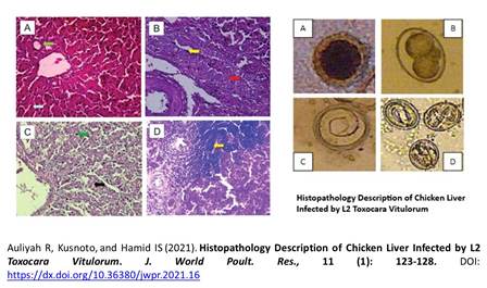 1400-29_-_Chicken_Liver_Infected_by_L2_Toxocara_Vitulorum